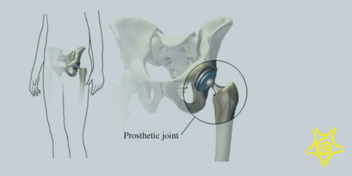 2010.03.23 cadera papa
